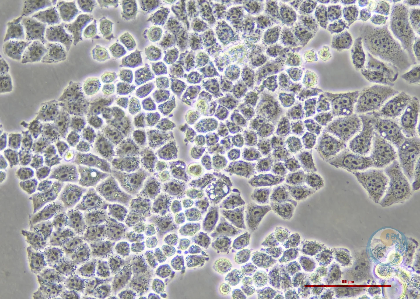 人宫颈癌细胞顺铂耐药株 Hela-DDP 2