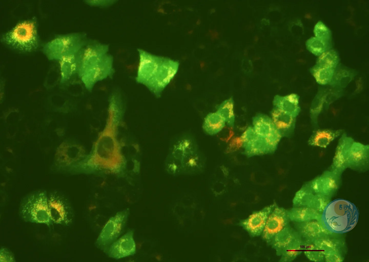 人非小细胞肺癌细胞稳转株 A549-LC3-GFP-RFP 4