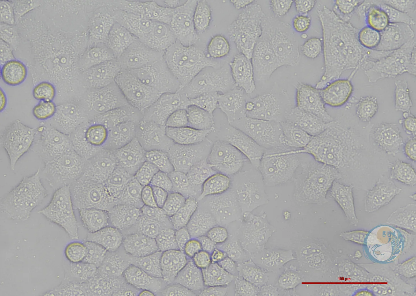 人胰腺癌细胞-绿色荧光标记 PANC-1-EGFP 3
